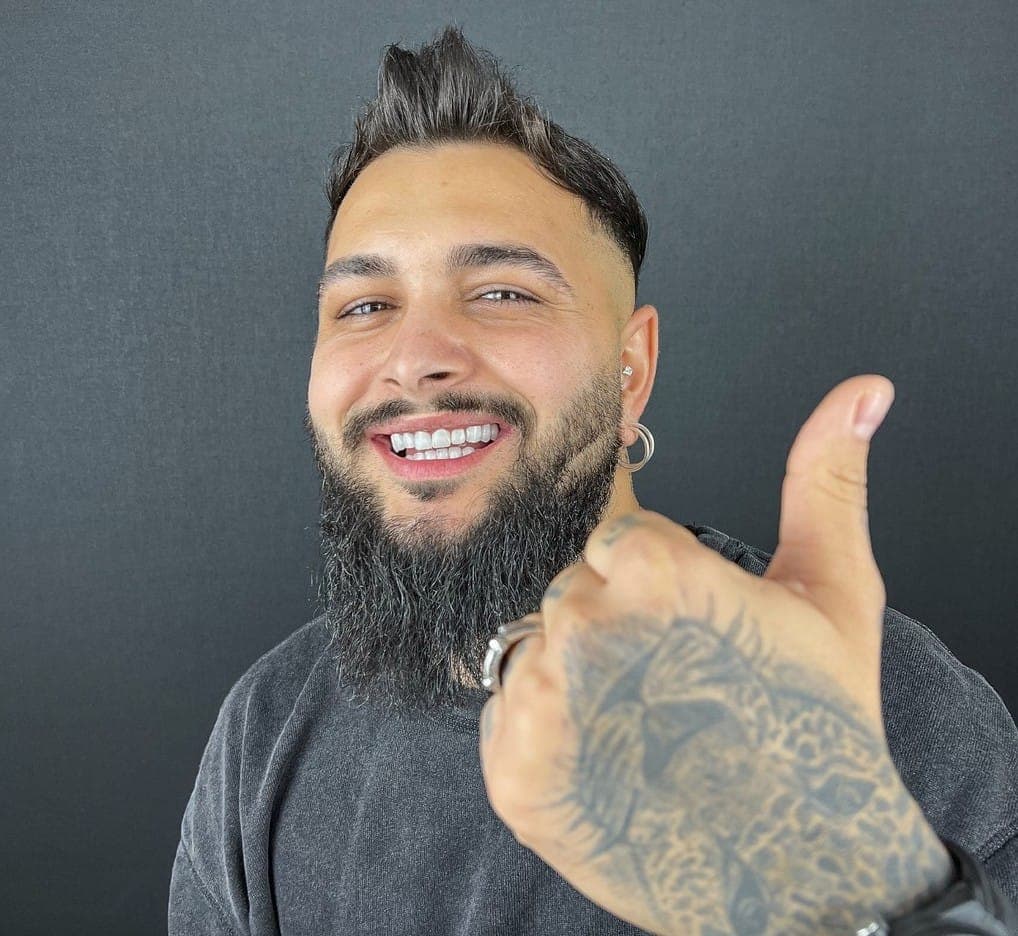 Hollywood Smile, before and after